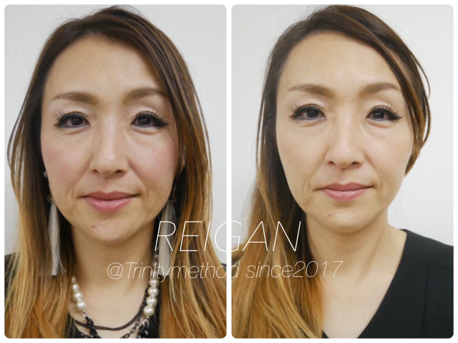 大阪の小顔矯正スクールは日本戻顔美容協会