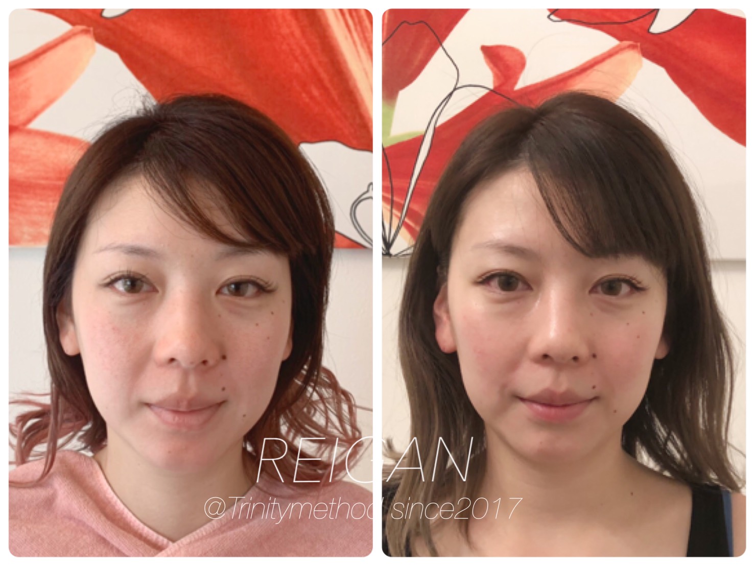 大阪の小顔矯正を習うなら日本戻顔美容協会